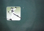 CBC Image 1
